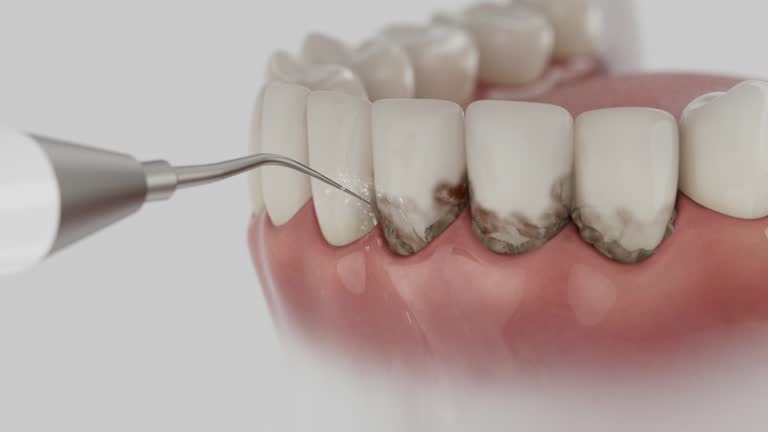 Trusted Tooth Extraction service in Centerville, TN - Dentist Open Now